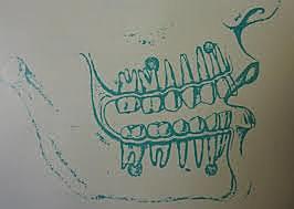 ÉPOCA DE LA CONCRECIÓN (AFIRMACIÓN) DE LA ENDODONCIA