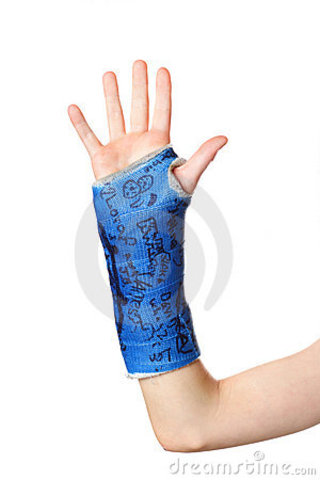 My first broken bone was my arm