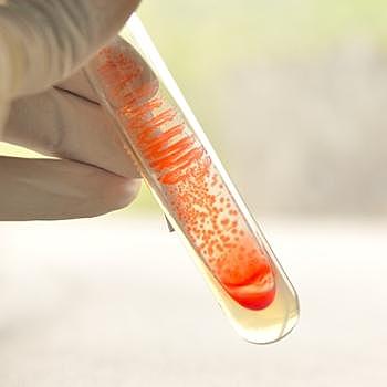 Discovery of Penicillin. First successful Penicillin dosage on a Human.