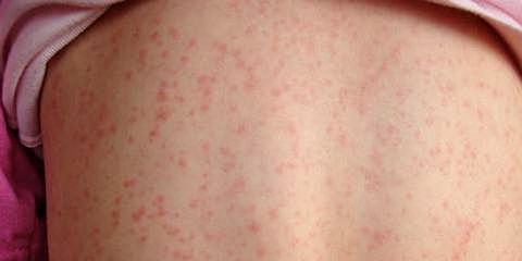 Elizabeth y Caroline