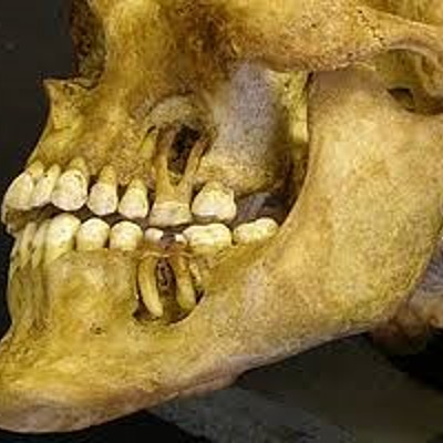 Timeline: Historia del Níquel Titanio en Endodoncia