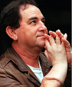 First Arm Transplant