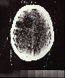 CT Scanners. First CT scan on the Human Brain