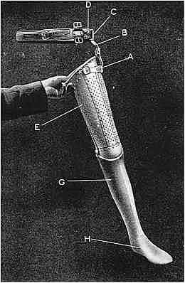 Prosthetics made from Aluminium. First physical Aluminium Prosthetic leg