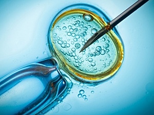 fertilizante industrial