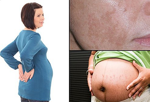 Second Trimester: Physical and emotional changes in a woman,