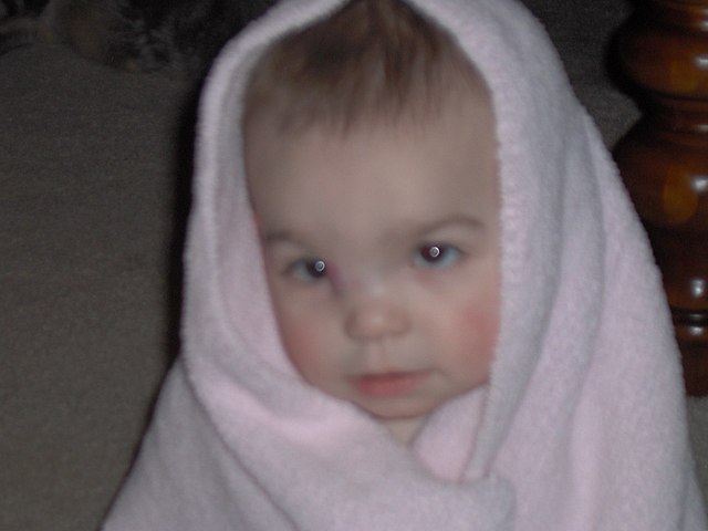 Isabelle's Diaganosis