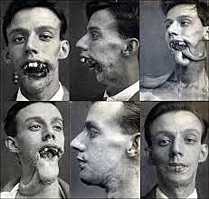 Cirurgias plásticas