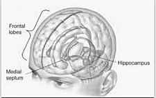 Neuropsicología cognitiva