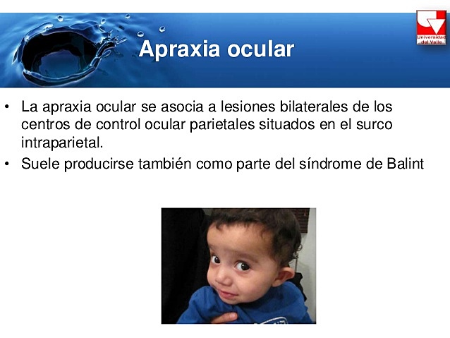 Kleist (1912), y, e Poppelreuter (1917)