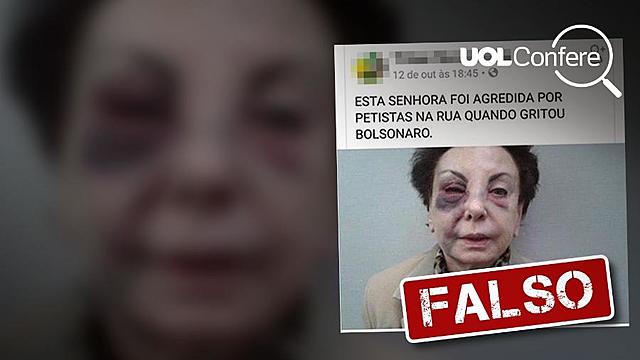 A senhora que supostamente tinha sido agredida por ser eleitora de Bolsonaro (que na verdade era Beatriz Segall, já falecida