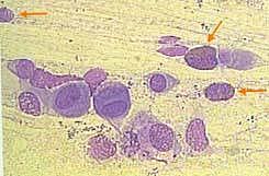 Versión Amarilla del proyecto BSCS