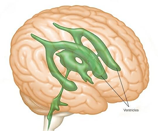 Ventrículos cerebrales sin espíritu