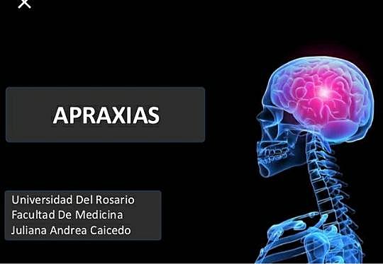 Hemisferio izquierdo