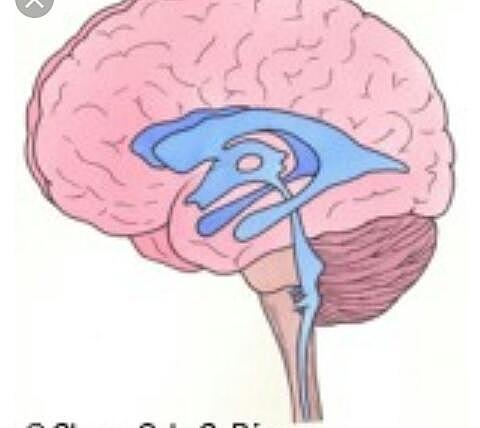Ventrículos cerebrales sin espíritu