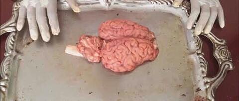 Técnicas de disección cerebral