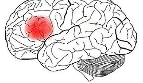 Ubicación del lenguaje articulado