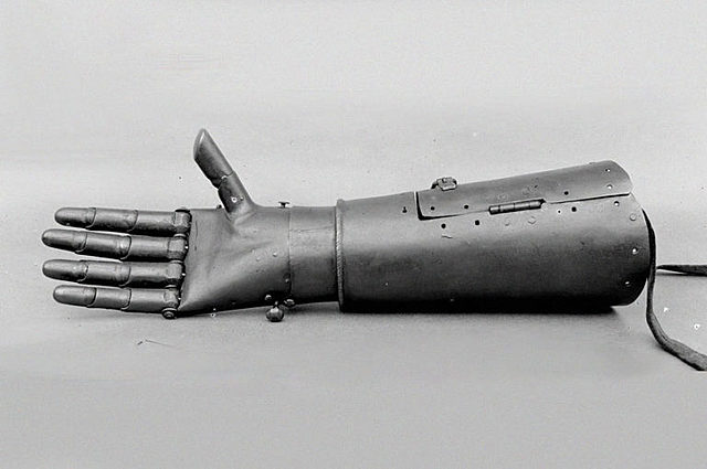 Первый бионический протез