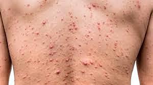 Paul Ehrlich (1854-1919)