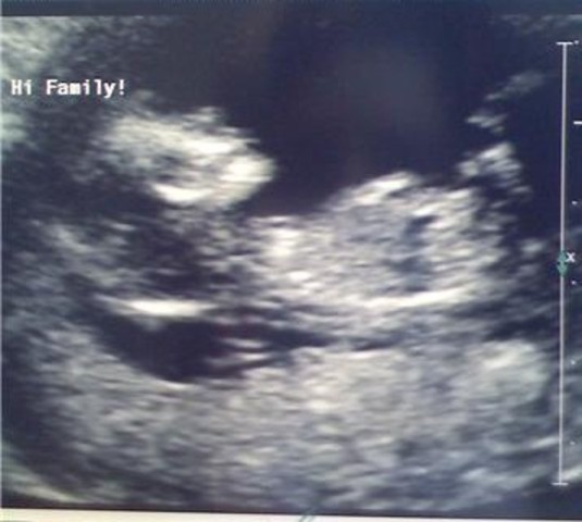 Prenatal Development & Birth