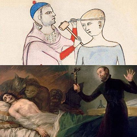 Tratamientos para mejorar la salud Mental