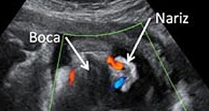 semana treinta y cuartro