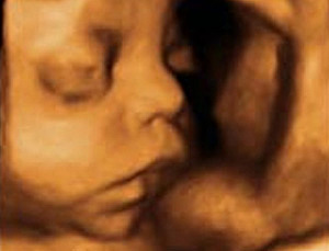 TRIGÉSIMA PRIMERA SEMANA