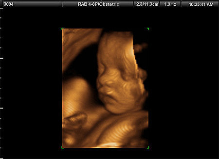 TRIGÉSIMA TERCERA SEMANA