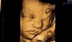 TRIGÉSIMA CUARTA SEMANA