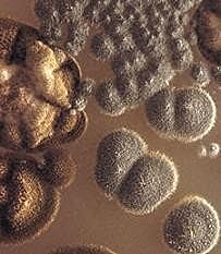 Primeras observaciones de los microorganismos