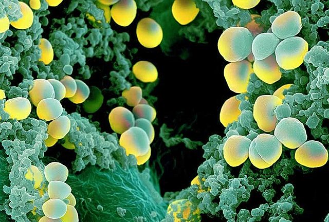 Cadena de la Polimerasa