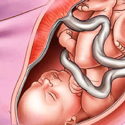 Timeline: Desarrollo en el embarazo.