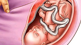 Timeline: Desarrollo en el embarazo.