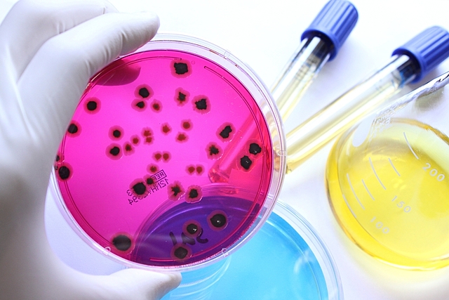 Origen de los microorganismos