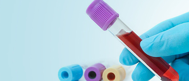 Estudios a la sangre