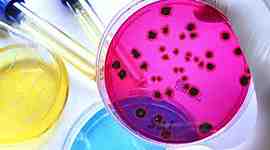 Timeline: Historia de la microbiología