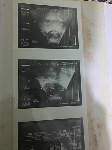 observe mi radiografía