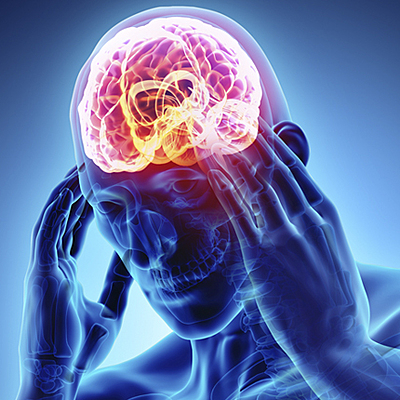 Timeline: Caso clinico ACV