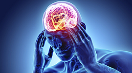 Timeline: Caso clinico ACV