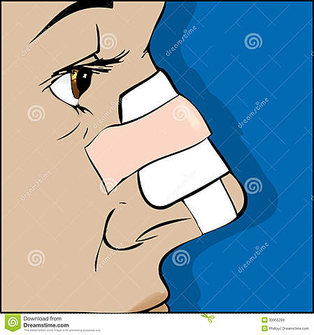 Yossarian breaks Natly’s nose