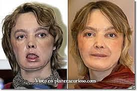 ADELANTOS EN MEDICINA