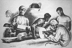 Anestesia (1842-1846) Medicina