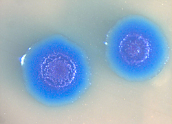 El primer trasplante de un genoma completo de una bacteria hacia otra bacteria