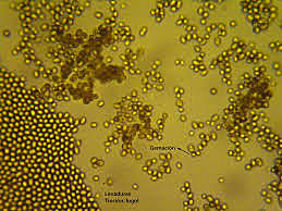 Finalización de la secuencia completa de la levadura