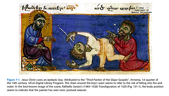 "Enfermedad sagrada"[4]