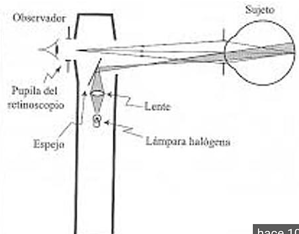 RETINOSCOPIO CUIGNET