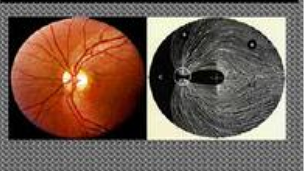 OFTALMOSCOPIO Primera Observación oftalmoscópica