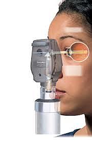 Oftalmoscopios modernos