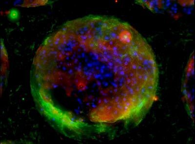 Órganos artificiales