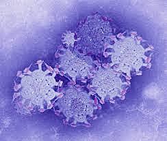 H1N1 INFLUENZA PORCINA